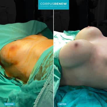 Slider image (9) CorpusRenew by Termessos Hospital